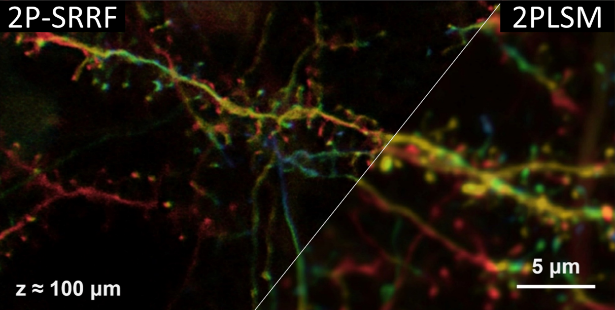 Overview of “Fluorescence Radial Fluctuation enables two-photon super resolution microscopy.”