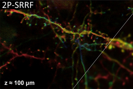 時空間での蛍光相関解析が生体深部超解像イメージングを可能にする（記事サムネイル）