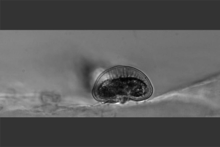 How Does a Shelled Amoeba Move? (Thumbnail Image)